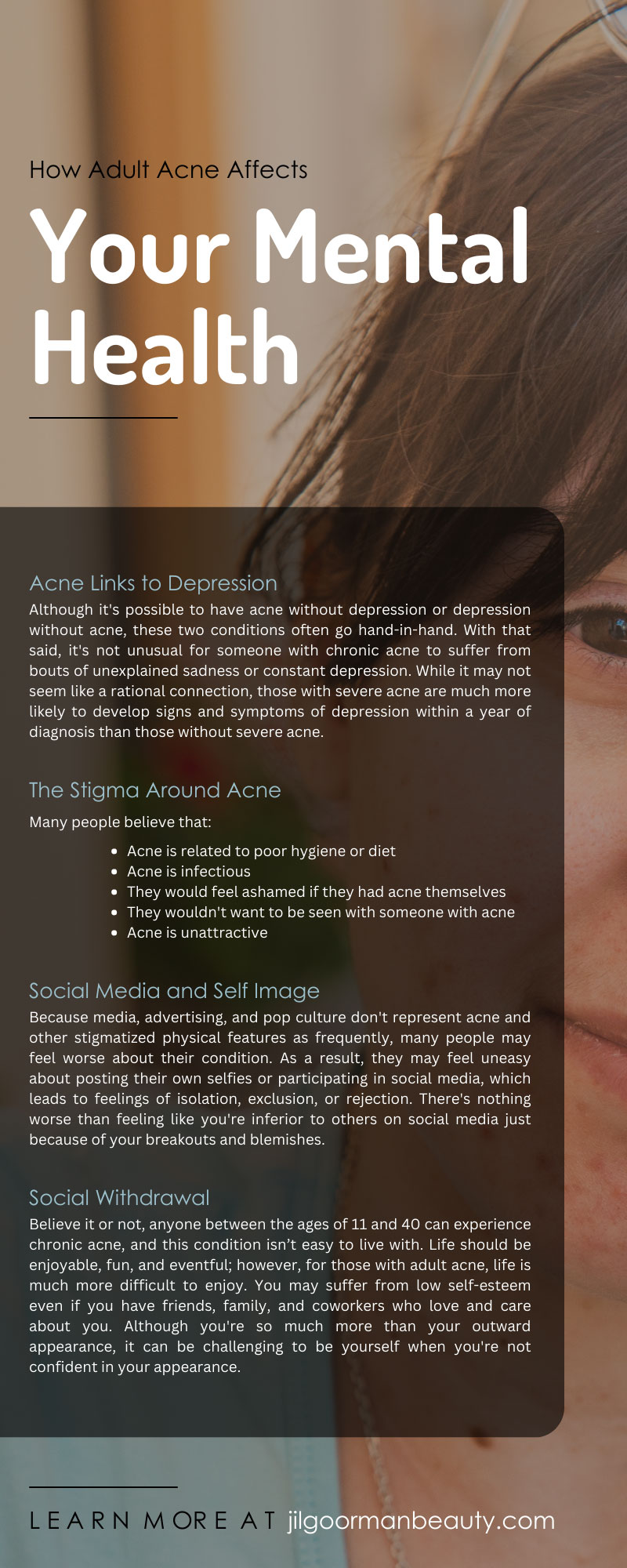 How Adult Acne Affects Your Mental Health