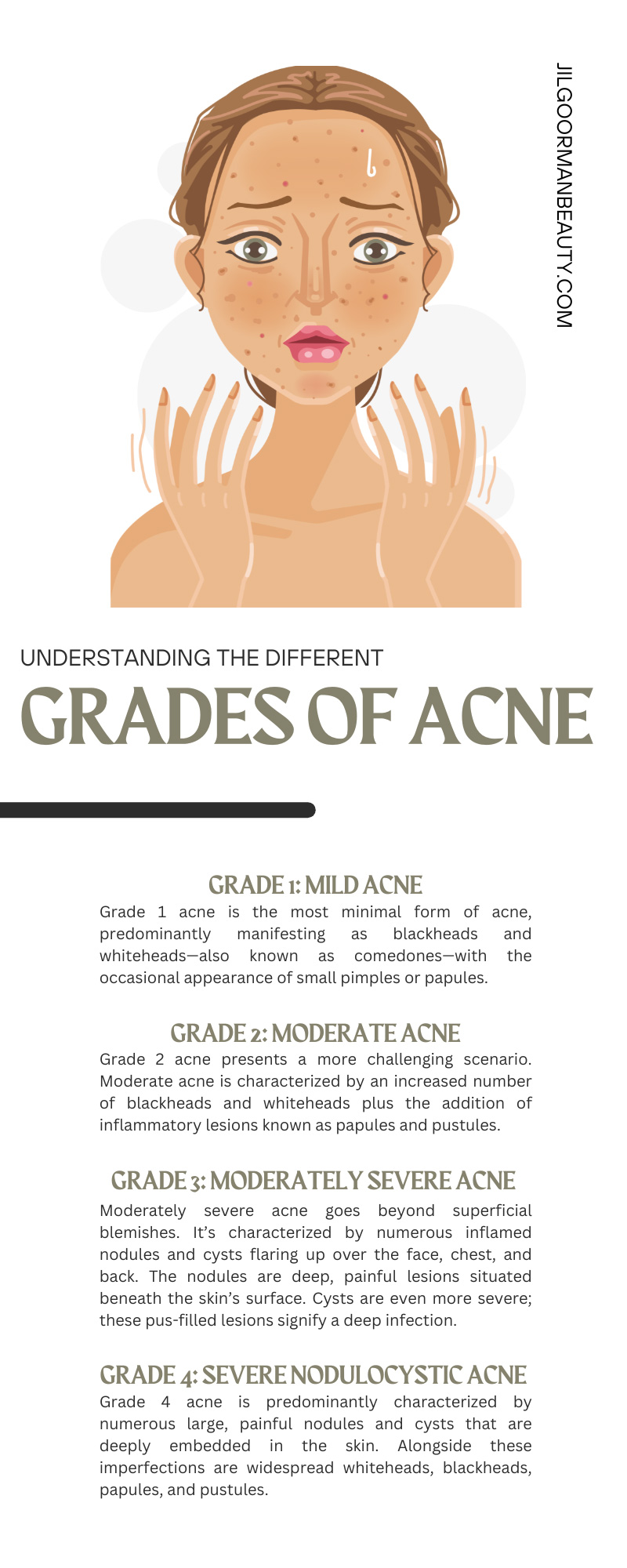 Understanding the Different Grades of Acne